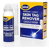 Scholl Freeze Away Skin Tag Removal Kit - Removes Skin Tags in As Little As 1 Treatment - Safe and Effective Skin Tag Remover