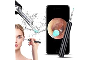 IDUOLA Ear Wax Remover Tool Earwax Removal Cleaner- Professional Ear Cleaner Camera Endoscope 1080p FHD Wireless Otoscope with 6 LED Lights Ear Scope Wax Cleaning Kits for iPhone, iPad & Android Smartphones