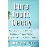 Cure Tooth Decay: Remineralize Cavities and Repair Your Teeth Naturally with Good Food
