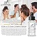 Art Naturals® Anti Acne Serum Treatment 30ml- Dermatologist Tested Product, Made with Revolutionary Evermat® & Organic Ingredients to Help Control & Get Rid of Acne - Best Pore Minimizer -For all Ages