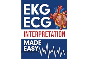 EKG | ECG Interpretation Made Easy: An Illustrated Study Guide For Students To Easily Learn How To Read & Interpret ECG Strips