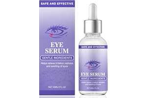 MUIEFE Stye Eye Treatment, Natural Stye Eye Serum for Styes Chalazion & Blepharitis, Eye Relief Serum for Dark Circles, Relieve Puffiness Serum, E-ye Drops for Infected E-yes, Restore Healthier E-ye Skin