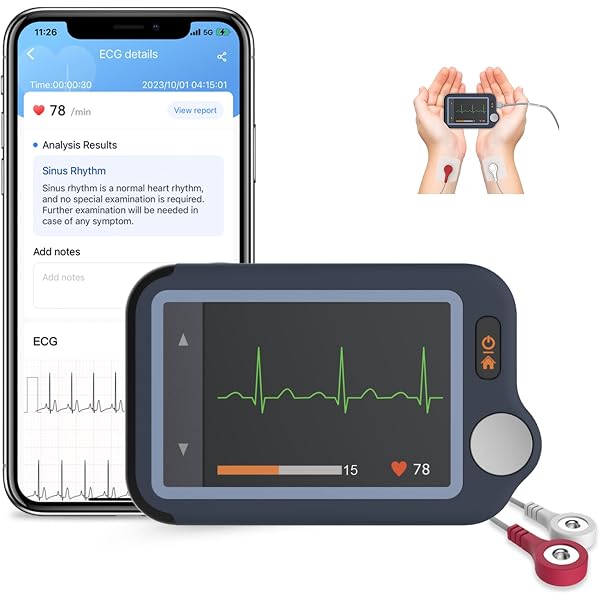 Custodia Rigida EVA Per Monitor ECG Portatile EMAY 6L (EMG-6L) - Protezione Da Viaggio - 2