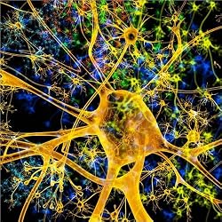Cuadro sobre lienzo 70 x 70 cm: Neurona amarilla