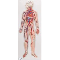 3B Scientific Anatomie-Modell – Menschliches Herz Mit Linksventrikulärer Hypertrophie (LVH), 2-teilig + Kostenlose 3B Smart Anatomy App