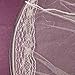 niceEshop(TM) White Elegant Lace Bed Canopy Mosquito Net
