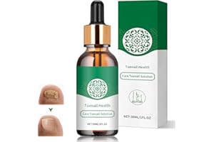 YAGASPANTERY Nagelpflege Behandlung, 30ml Brüchige Nägel Nail Repair, Nail Care, Fußnägel Behandlung für Bei Harten Dicken Zehennägel