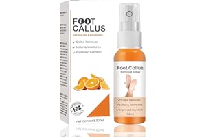 MRCUVARYAS Spray per la rimozione dei calli dei piedi, spray per peeling istantaneo ai piedi, olio d'arancia, spray idratante e nutriente, per talloni ruvidi screpolati, calli e pelle secca delle dita, nutre la