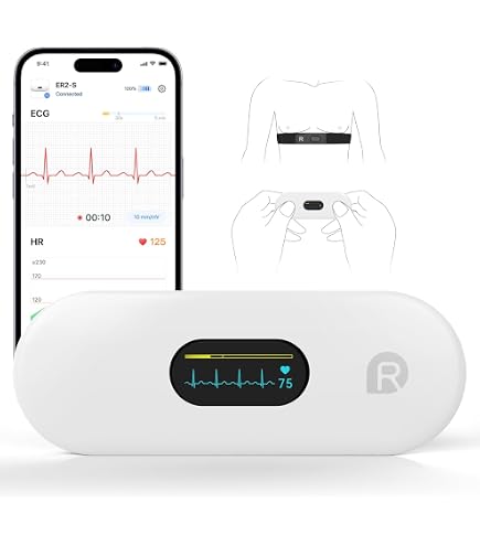 ELETTRODI AMBU BLUE SENSOR VL-00-S/25 - snap confezione 25 pezzi