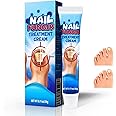 Nail Repair Cream,Fingernail Toenail Care,Strong Anti-Fungal Toenail Cream,Nail Repair Nourishing Treatment,Restores Discolored and Damaged Nails 20g