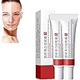 Whitening Freckle Cream,Acne Scar Removal Treatment Cream,Pigmentation Removal Cream For Face,Remove Melasma Acne Cream Fading Spot Cream,Dark Spot Corrector For Face (2PCS,Whitening Freckle)