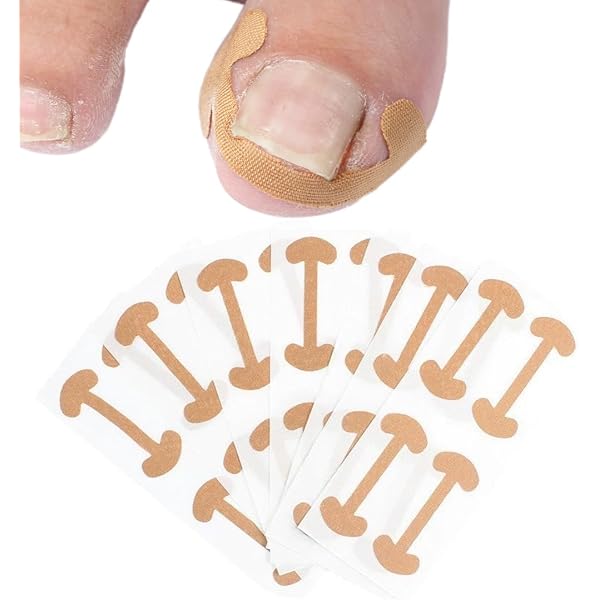 CATOR 50-teiliges Set Gegen Eingewachsene Zehennägel – Mit Korrekturstreifen & Nagelheber – Schmerzfrei