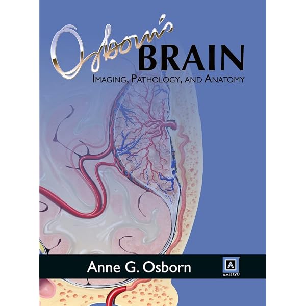 Buy OSBORN'S BRAIN, 2ND EDITION Book Online at Low Prices in India