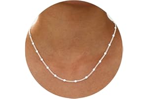 ESPVO 1.5mm/2mm S925 Silver Chains Necklaces for Women Dainty & Hypoallergenic Sterling Silver Necklaces Jewelry Birthday Gifts for Girls 16/18/20/22inch