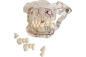 YOUYA DENTAL Neural Repair Dental Model Implantat Krankheit Zahnmodell Zahnarzt Standard Pathologische Abnehmbare Zähne Lehrmodell für Zahnarzt Schule Bildung Lernen