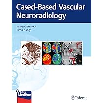 健康・医学 Decision Making in Neurovascular Disease Decision Making in Neurovascular Disease: 9781684200573