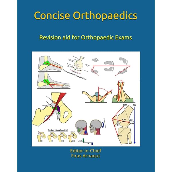 Surgical Exposures in Orthopaedics: The Anatomic Approach