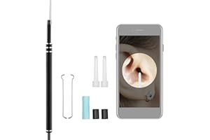Camnoon 720P Limpiador Visual de oídos Eliminación de Cera de oídos Endoscopio Otoscopio 1 megapíxeles para teléfono Inteligente Tableta Limpieza de computadora Oreja, Boca, Nariz, Piel, Mascotas