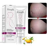Stretch Mark Cream, Remove Pregnancy Scars, Treatment of Stretch Marks, Maternity Repair, Remove Stretch Marks of Pregnancy,