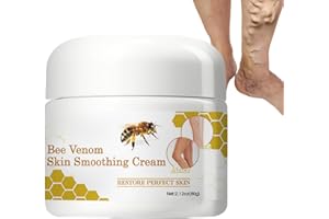 HIVETZ Bee Ve-nom Varicose Relief Veins Cream,Bee Ve-nom Cream for Spider Veins,Varicose Veins Cre/am,Varicose Veins Treatment Cre/am,Spider Veins Repair Crea/m Improve The Look of Legs,Leg Vei/n Crea/m