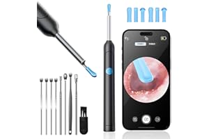 FORBANY Reyova Oreille Nettoyeur Électronique avec Caméra HD et Embouts en Silicone Réutilisables pour Nettoyage Doux et Précis