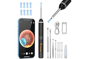 ‎VITCOCO Ohrenschmalz Entferner Otoskop, VITCOCO 5MP HD Ohrenreiniger, 3,0mm Ohrreiniger IP67 Wasserdicht, Wifi Ohr Reiniger Für iPhone, iPad Und Android-Smartphones (Schwarz)