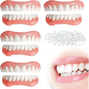 Kit di fissaggio per riempimento permanente dei denti Kit di fissaggio per riempimento permanente dei denti