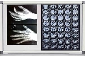 GMBAYUE Professionelle Röntgenfilm-Leuchtbox, Dia Viewer Leuchtkasten, Laborausrüstung, 0-100 % Einstellbare Helligkeit, Keine Schatten für Den Einsatz in Kliniken, Krankenhäusern und Laboren(33x19x0.5in/77x4