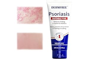 YOLONCE 100ml Feuchtigkeitsspendende Gesichtscreme,Anti-Juckreiz-Creme,Feuchtigkeitscreme,Repair Creme,Salbe reduziert den Juckreiz,beruhigt Haut,zieht schnell ein