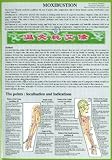 Image de Moxibustion