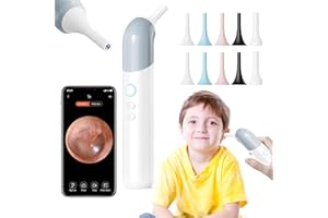 QIMIC Wireless Otoscope Ear Camera - 1080P WiFi Otoscope with 6 LED Lights, Ear Scope Camera with 10 White Accessories for Kids,Pets &Adults,Support Photo and Video, Compatible with Android and iPhone