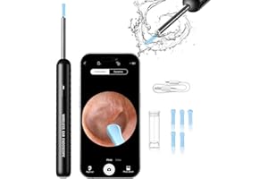 AKDOMART Ohrenschmalz Entferner Otoskop, 1080P Ohrenreiniger mit Kamera, IP67 Wasserdicht Ear Cleaner, 360°-Weitwinkel ohr reinigung kamera, WiFi Ear Wax Removal Camera für iPhone, iPad und Android-Smartphones