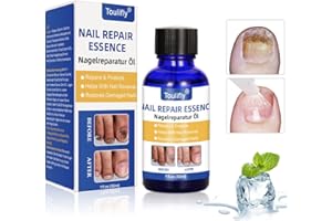 TOULIFLY Nail Fungal Treatment, Nail Fungal Treatment, Fungal Nail Cure, Nail Fungus Treatment For Toenail, Fungal Nail Treatment, Extra Strength Nail Fungal Treatment, Toenail Fungus Treatment, Nail Repair