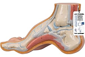 3B Scientific M32 Modelo de anatomía humana Pie Arqueado, Pes Cavus + App de anatomía gratuita - 3B Smart Anatomy