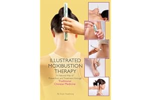 Illustrated Moxibustion Therapy: A Natural Way of Prevention and Treatment Through Traditional Chinese Medicine