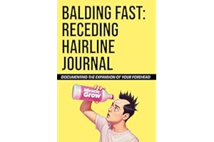 Receding Hairline Journal: Blush-Inducing Gag Gift for Balding Men - Designed to Embarrass Friends, Family, and Co-workers | Outrageously Funny