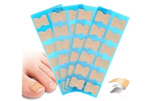 ZJCHAO Toppa Con Unghia Incarnita, Correzione Unghie Senza Colla, Correzione Paronichia Trattamento Di Cura Del Piede Toppa Con Incarnizione Dell'unghia(1#)