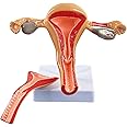 YUNZHIDUAN Uterus Model,Ovary Model, Anatomy Female Reproductive Organ Model, Shows Uterus, Ovary, Vagina, Uterine Medical Teaching Anatomical Gynecology Doctor Patient Communication Simulation
