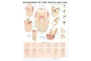 ANATOMICAL CHART COMPANY Disorders of the Teeth and Jaw Anatomical Chart