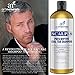 Art Naturals Scalp18 Coal Tar Therapeutic Anti Dandruff Shampoo 473ml - Helps clear symptoms of Psoriasis, Eczema, Itchy Scalp & Dandruff - Made in USA with Natural & Organic Ingredients-Sulfate Free