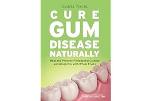 Cure Gum Disease Naturally: Heal Gingivitis and Periodontal Disease with Whole Foods