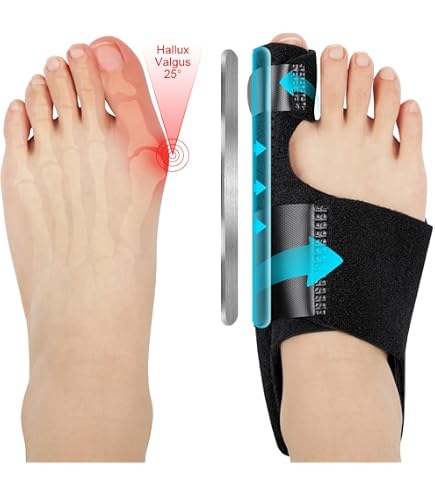 Pedimend™ 2X Bunion Protector Sleeve – Ultra Thin Hallux Valgus Corrector, Beige, One Size, UK Made