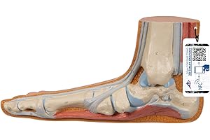 3B Scientific® Pied Plat (Pes Planus) – Modèle Anatomique Humain Taille Réelle + Smart Anatomy App (Garantie de 5 Ans)