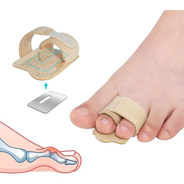 3 Paar Gel-Zehenspreizer Für Hammerzehen & Hallux Valgus – Weiches Silikon, Schmerzlindernd & Korrigierend