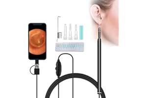 SANON Otoscope Ear Wax Remover Camera, Ear Cleaner HD Visual Camera with 6 Dimmable LED Adults Kids Pets Ear Scope for Android, Tablet and PC