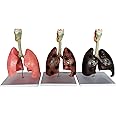 LKYLVEE Smokers Lung Model and Healthy Lung Model - Life Size Human Lung Anatomy Model - for Emonstrate The Effects of Smoking on Lung Health,Flesh,20cm