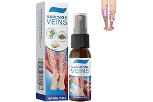 RIETOIU Timilk Veinguard Herbal Spray, Varicose Vein Soothing Spray,Natural Vein Healing Varicose Veins Treatment Spray,Professional Varicose Veins Treatment for Legs, Improve the Appearance (1 Pcs)