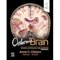 ExpertDDx: Brain and Spine : Salzman MD FACR, Karen L., Jhaveri MD