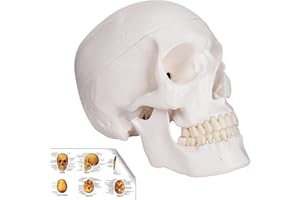 Ronten Klassik Schädel Modell, Schädel Anatomie Modell,Lebensgröße, Medizinische Anatomie, Erwachsenenmodell mit abnehmbarer Totenkopfkappe und beweglichem Mandible, komplettes Set von Zähnen