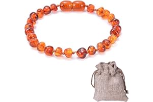 TYRZOL Baltic Amber Bracelet,Polished Cognac Color Anklet Handmade Polished Amber Beads Amber Necklace Amber Anklet Bracelet Handmade 100% Genuine Amber Beads - Premium Quality.